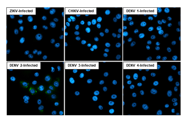 Anti-Dengue virus Capsid protein antibody [HL2791] used in Immunocytochemistry/ Immunofluorescence (ICC/IF). GTX639659